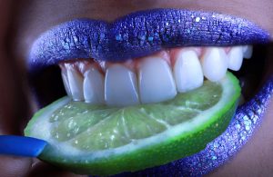 what to do before teeth whitening/ photo by pixbay